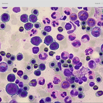 aetherAI Bone Marrow Smear Differential Counting