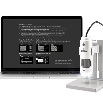 AROMASE ScalpX Intelligent Scalp Diagnosis System