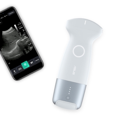 ASUS Wireless Handheld Ultrasound LU800 Series